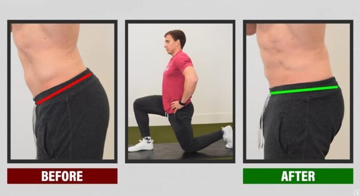 How To Fix An Anterior Pelvic Tilt