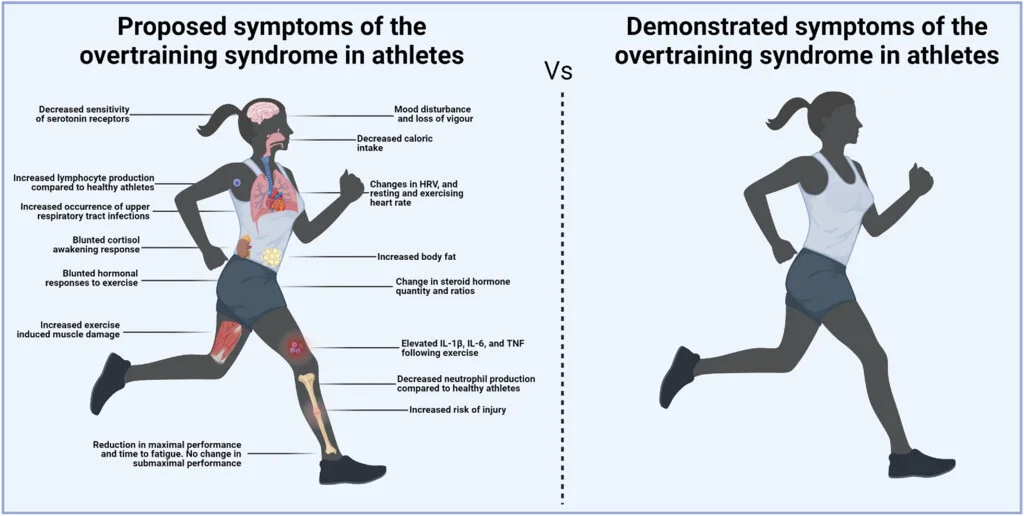 Overtraining Syndrome